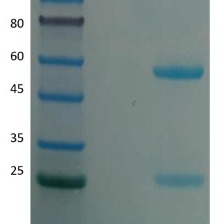 CD14-antibody