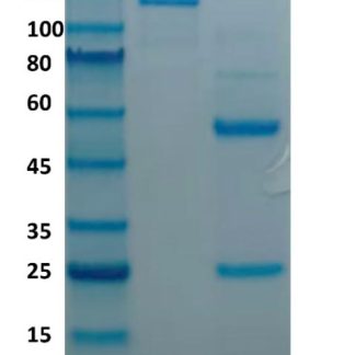 Mouse-anti-Human-Kappa-Light-Chain-Antibody
