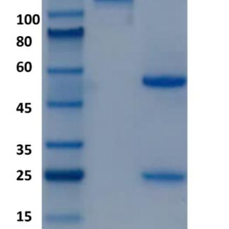 Mouse-anti-Human-lambda-Light-Chain-Antibody