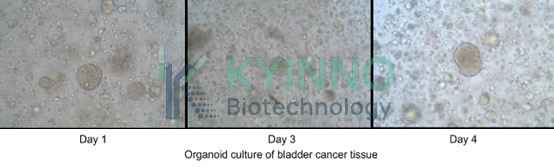 organoid culture of bladder cancer tissue